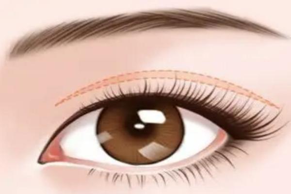 广州希玛林顺潮眼科医院收费贵吗