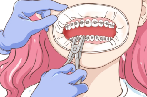 西安弗莱堡口腔医院医生介绍:牙齿矫正樊国瑶/种植牙蔡明河,附预约攻略+地址详情