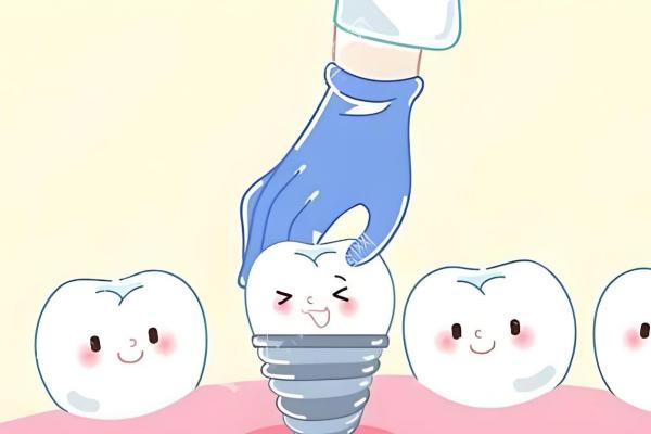 徐州中牙口腔种牙技术怎么样？数字化种牙方案精准，微创技术创口小恢复快！ 