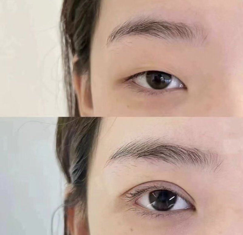 一、眼修复医生杨亚益医生怎么预约挂号