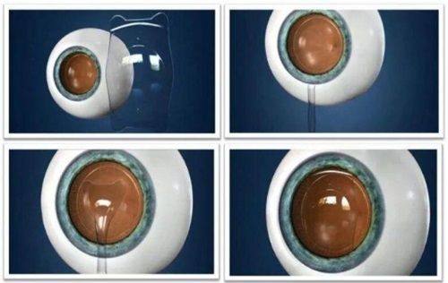 乌鲁木齐普瑞眼科和空军医院哪个好？各有所长，可挂号预约