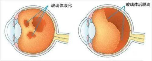 依视路星趣控授权门店怎么查询？多种渠道，价格和控近视效果大揭秘