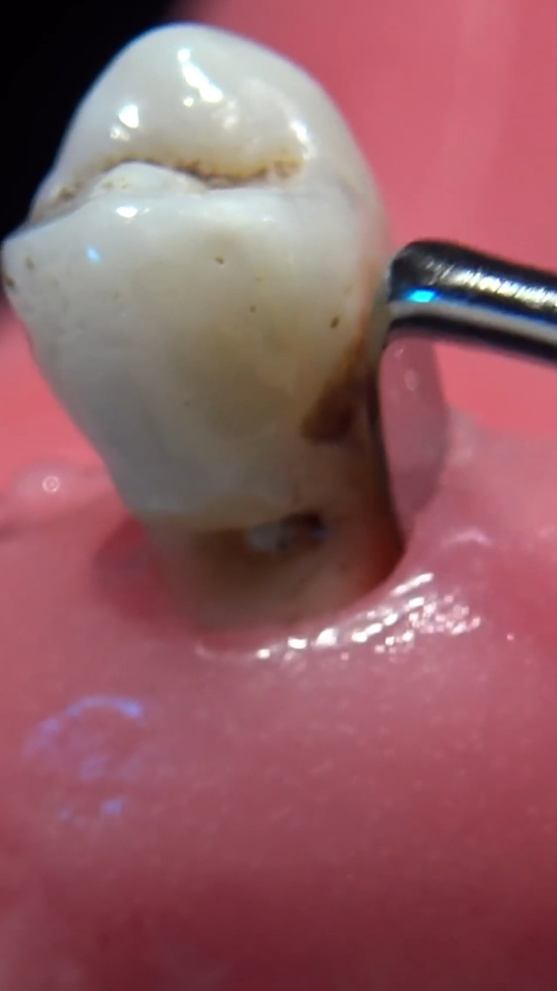 二、乐山启辰口腔医院价格表？（2023年常见项目收费标准）