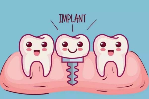 合肥中诺口腔医院种牙多少钱？韩国奥齿泰3.98k+/美国皓圣6.8k+/瑞典诺贝尔10k+