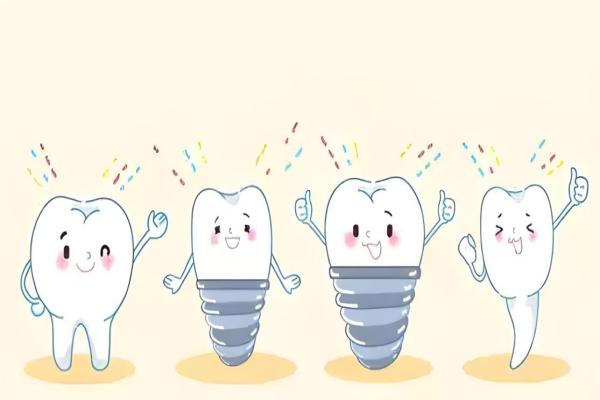 抚州英伦口腔种植牙怎么样？专业医生团队操作，先进技术保障，种牙稳固耐用效果好 