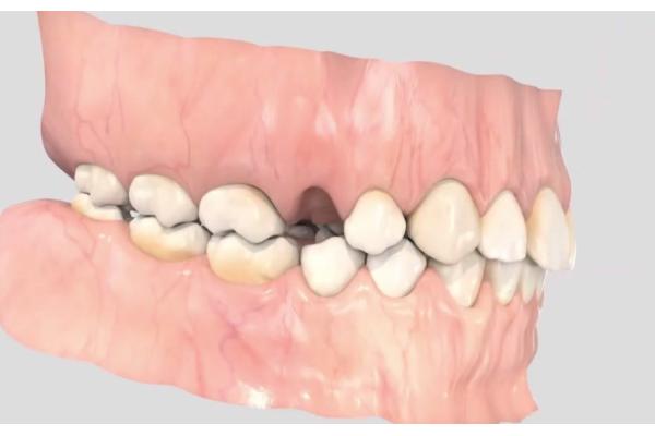 德州德诺口腔医院收费高吗？不高！价格实惠项目多，技术强口碑好，快来看！ 