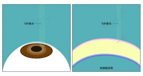 三、余克明个性化方案优势www.fakemusicmedia.com/