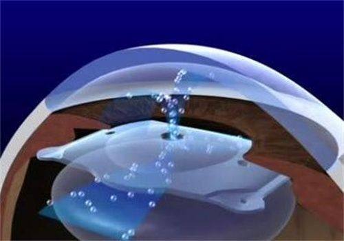 三、深圳博爱曙光医院眼科技术优势在哪www.fakemusicmedia.com/