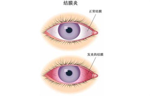 二、郑州麦迪格眼科诊所的技术优势如何www.fakemusicmedia.com/