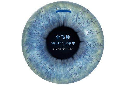 三、深圳博爱曙光医院眼科值得选择吗www.fakemusicmedia.com/