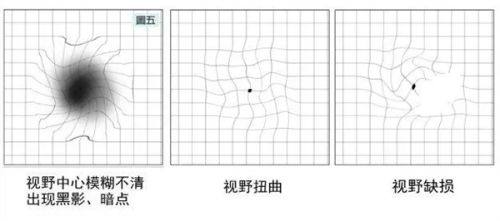 三、茂名电白爱尔眼科视光医院其他维度看点www.fakemusicmedia.com/