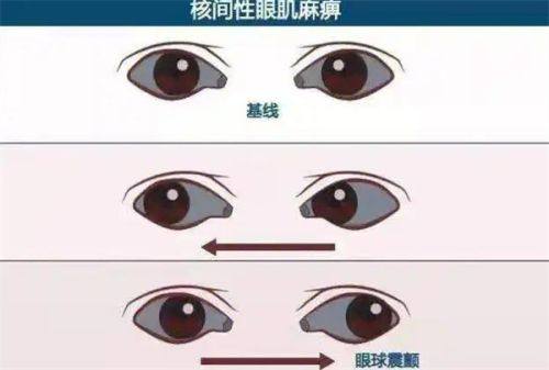 延吉爱尔眼科医院靠谱吗?先进设备与专业团队护航，患者正面反馈多，很靠谱 