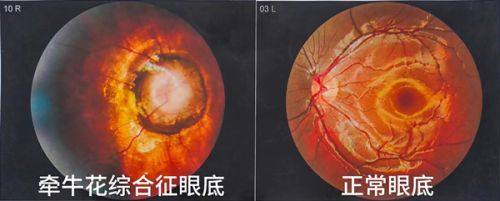 郑州市第一人民医院眼科地址在哪里？在河南省郑州市管城回族区东大街56号，东与紫荆山路交叉口东300米 