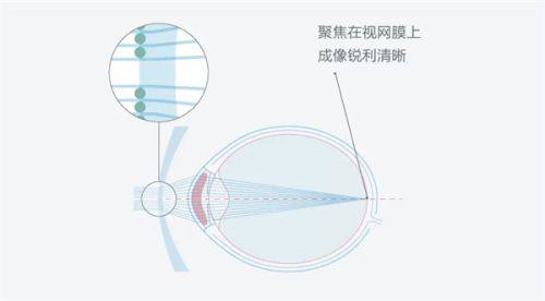 驻马店尖峰眼科医院靠谱吗？医院资质优规模大、专家多案例好