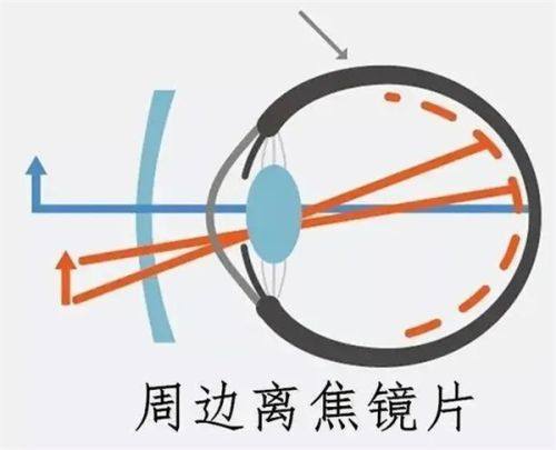 二、深圳博爱曙光医院眼科技术怎么样www.fakemusicmedia.com/