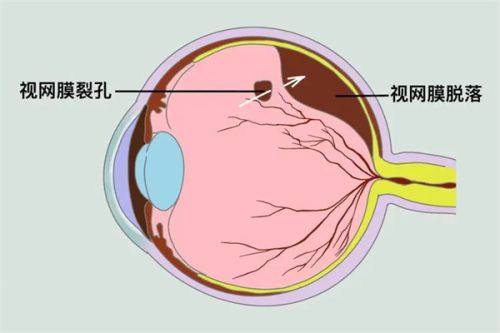 二、延吉爱尔眼科医院民营性质优势www.fakemusicmedia.com/