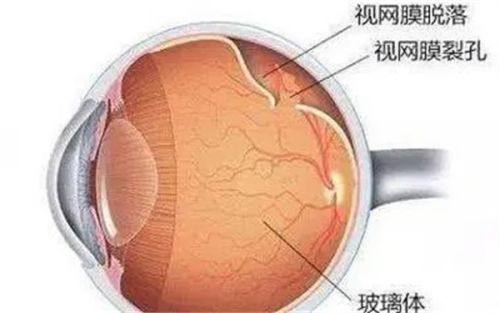 二、郑州市第一人民医院眼科医生技术如何www.fakemusicmedia.com/