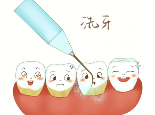 （一）徐州中牙口腔医院种植牙怎么样之真实口碑见证