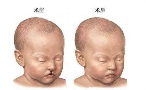 一、广州艺星医疗美容医院是正规的吗？（根据文章内容总结出明确回答字数在10-20字）