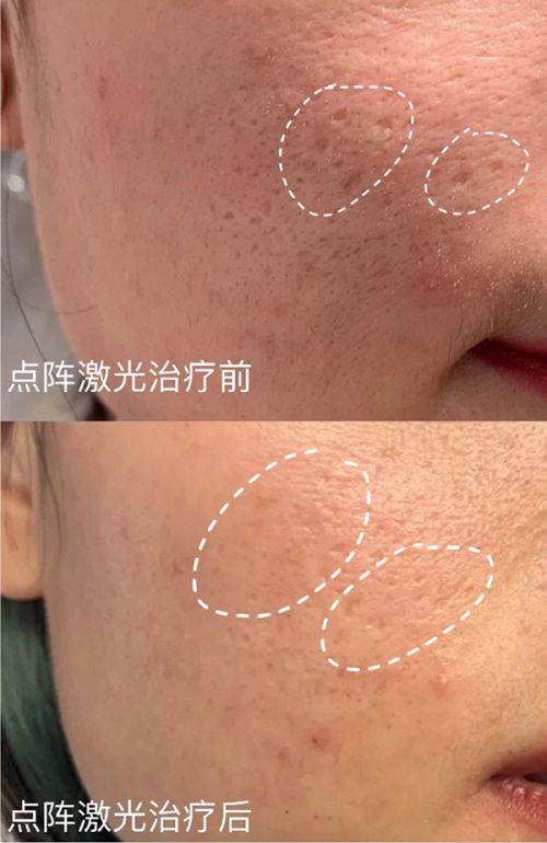 二、广州艺星医疗美容医院怎么样?真实实例见证实力