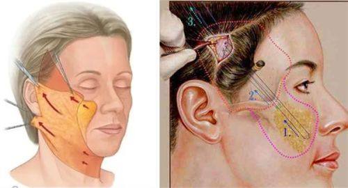 台州维多利亚医疗美容医院收费贵吗？不贵！结合最新价目表看，项目透明实惠超安心！