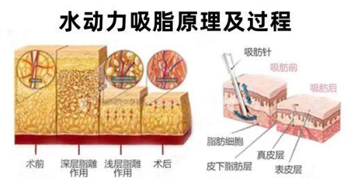 广州艺星医疗美容医院是正规的吗？医生团队技术精湛项目齐全服务贴心；