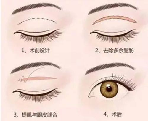 北京蒂凡妮医疗美容门诊部好不好？专精团队打造自然美，技术实力与口碑兼具的选择