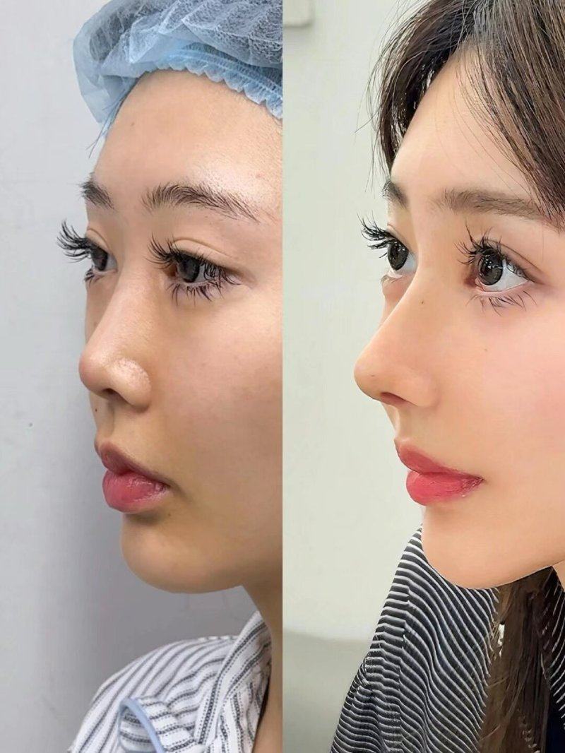 北京蒂凡妮医疗美容门诊部地址在哪里？位于北京市核心地段，技术精良医生团队实力雄厚服务贴心