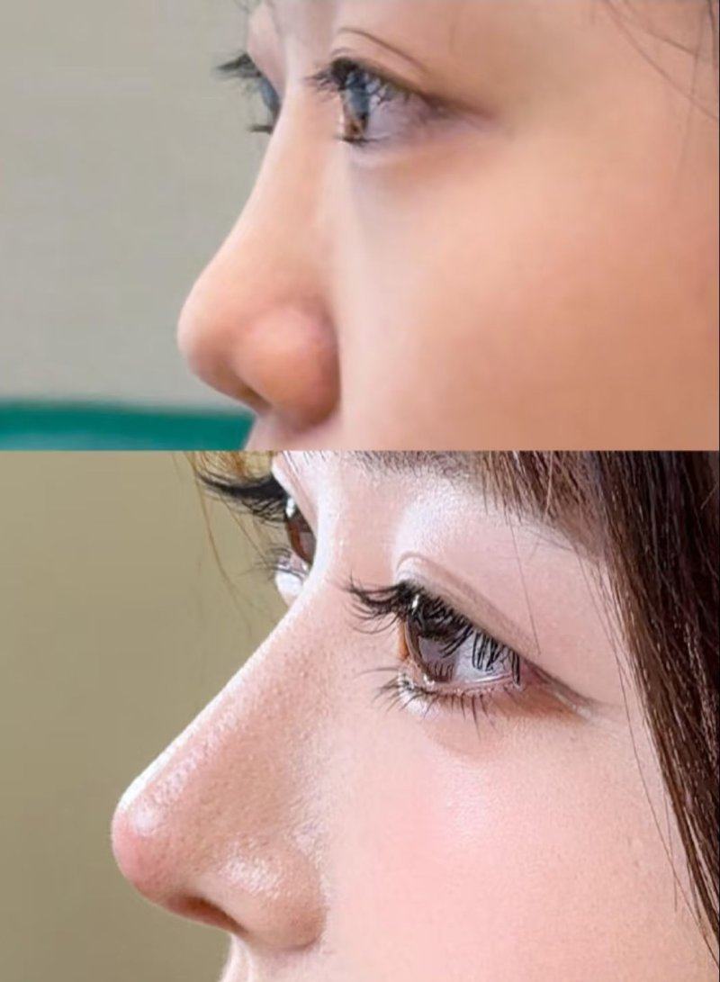 湖南省医美医院最厉害的三个医生技术如何？精准塑美实力圈粉；