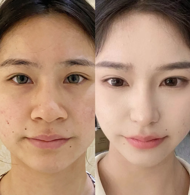 广州艺星医疗美容医院怎么样？医生团队专精，服务贴心周到