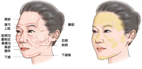 小结：
