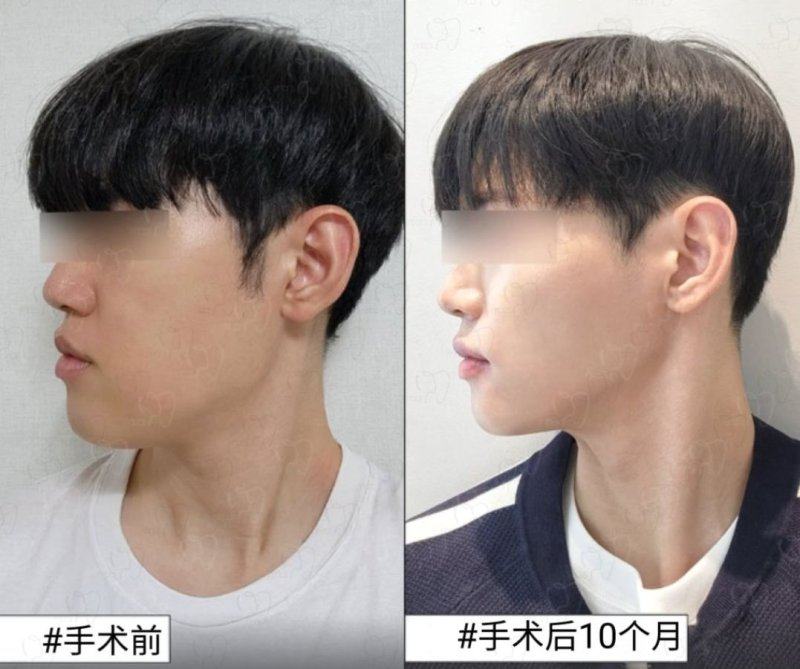 二、如何预约台州维多利亚医疗美容医院？快速获取专属美丽方案