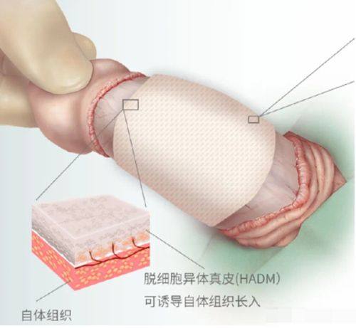 二、北京丽合医疗美容医院医生介绍：如何预约挂号并享受优质服务？www.fakemusicmedia.com/