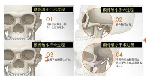 二、广州雅贝壹医疗美容门诊部预约方式有哪些?在线预约更便捷!www.fakemusicmedia.com/
