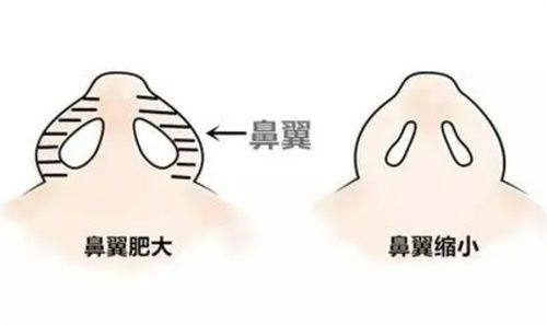 一、广州紫馨整形外科医院是正规的吗？（专精资质认证，实力不容小觑）www.fakemusicmedia.com/