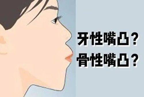 二、盐城中喜口腔做贴面的医生技术靠谱吗？www.fakemusicmedia.com/
