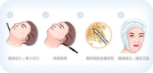 一、广州雅贝壹医疗美容门诊部地址在哪里?坐落于天河区核心地段交通便捷www.fakemusicmedia.com/