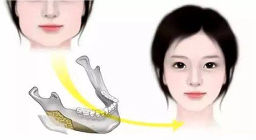 一、广州丽合医疗美容医院做鼻子怎么样？专精团队+精良技术=出色成效www.fakemusicmedia.com/