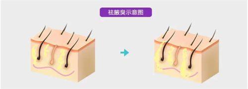 二、深圳悦己悦心医疗美容医院超声 刀成效如何?真实实例告诉你答案www.fakemusicmedia.com/