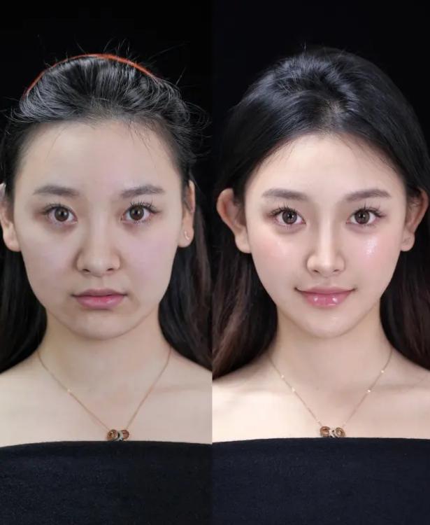 二、广州雅贝壹医疗美容门诊部收费标准怎么样？www.fakemusicmedia.com/