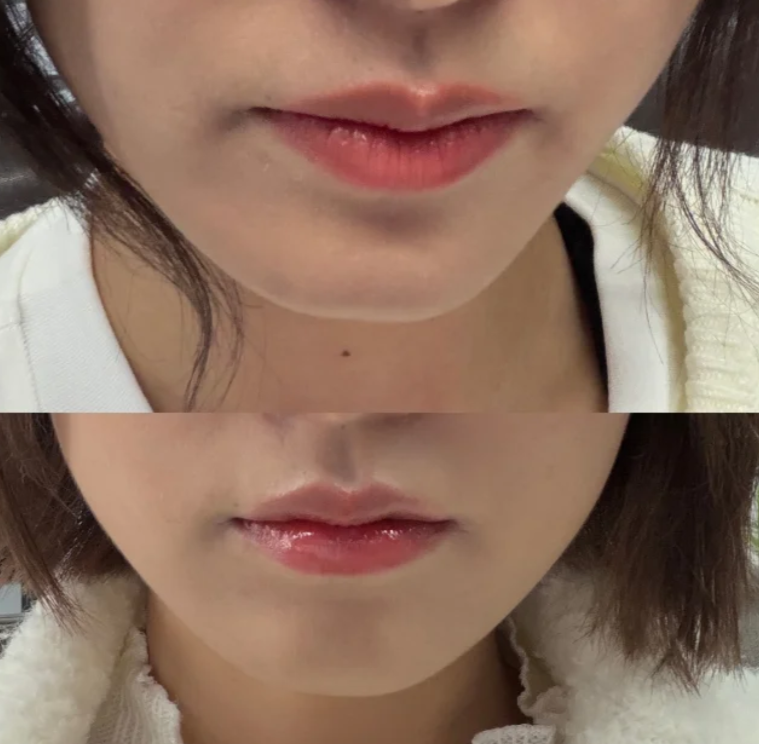 二、深圳伽美贝拉医疗美容门诊部预约挂号方式有哪些?在线预约更便捷www.fakemusicmedia.com/