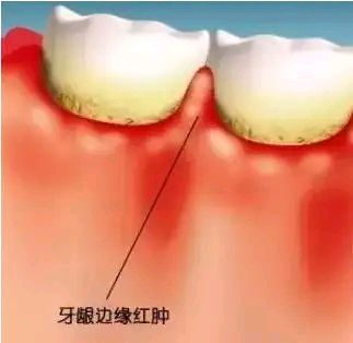 三、在盐城中喜口腔看牙大概多少钱及如何预约？www.fakemusicmedia.com/