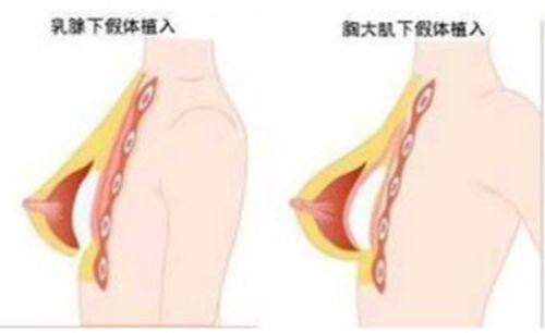 一、佛山曙光金子医学美容医院营业时间公布?(全天候贴心服务,满足您的变得更美需求)www.fakemusicmedia.com/