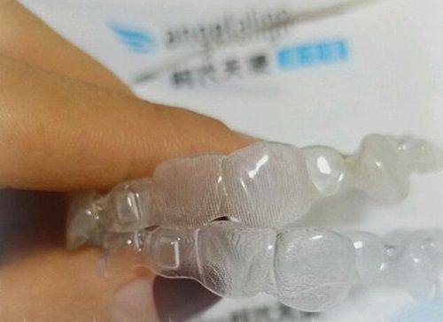 三、影响矫正费用的关键因素解析