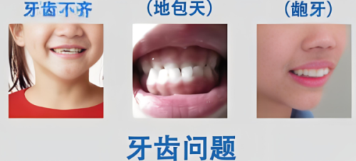 二、上海迈维口腔门诊部口碑评价怎么样相关标题，同意维度www.fakemusicmedia.com/