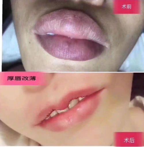 (一) 深圳阳光整形美容医院www.fakemusicmedia.com/