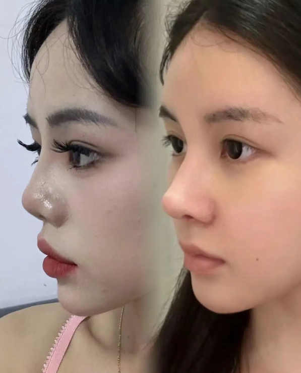 (三) 深圳艺星医疗美容医院www.fakemusicmedia.com/