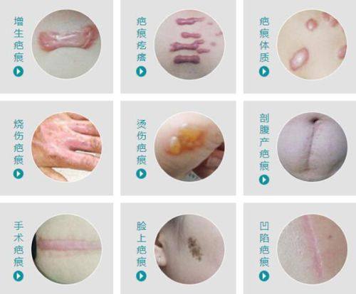 二、昆明艺星医疗美容医院有哪些特色项目?金辉院长眼部整形成热门选择www.fakemusicmedia.com/