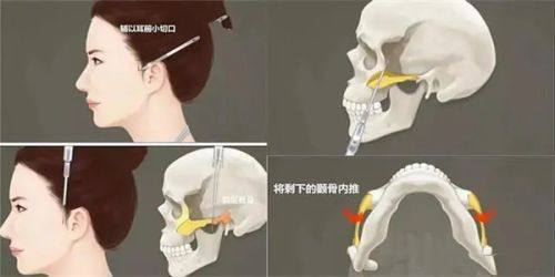 一、昆明艺星医疗美容医院吸脂怎么样？核心技术优势显著www.fakemusicmedia.com/