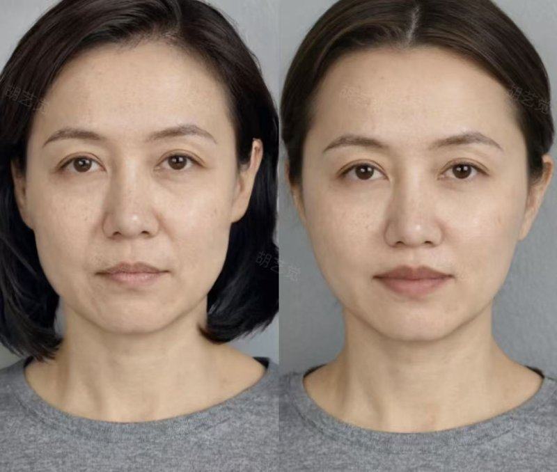 一、上海医美排名前十:技术与口碑兼具的优选机构www.fakemusicmedia.com/